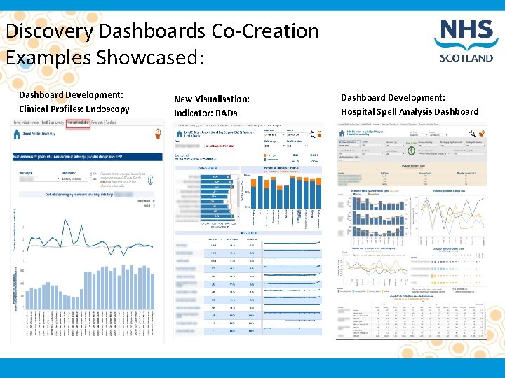 Discovery Dashboards Co-Creation Examples Showcased: Dashboard Development: Clinical Profiles: Endoscopy New Visualisation: Indicator: BADs