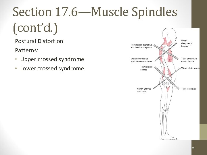 Section 17. 6—Muscle Spindles (cont’d. ) Postural Distortion Patterns: • Upper crossed syndrome •