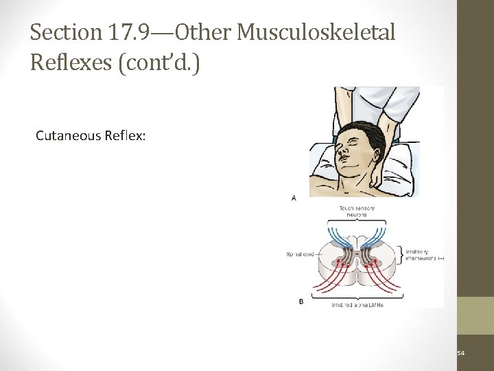 Section 17. 9—Other Musculoskeletal Reflexes (cont’d. ) Cutaneous Reflex: Figure 17 -17 A ,