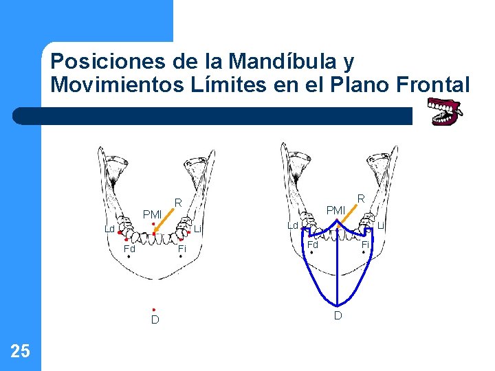 Posiciones de la Mandíbula y Movimientos Límites en el Plano Frontal PMI R Ld