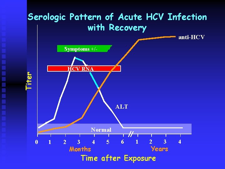 Serologic Pattern of Acute HCV Infection with Recovery anti-HCV Symptoms +/- Titer HCV RNA