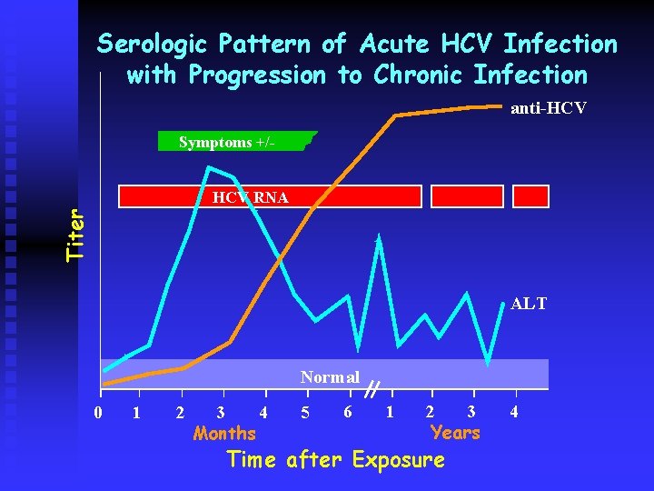 Serologic Pattern of Acute HCV Infection with Progression to Chronic Infection anti-HCV Symptoms +/-