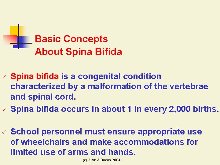 Basic Concepts About Spina Bifida ü ü ü Spina bifida is a congenital condition
