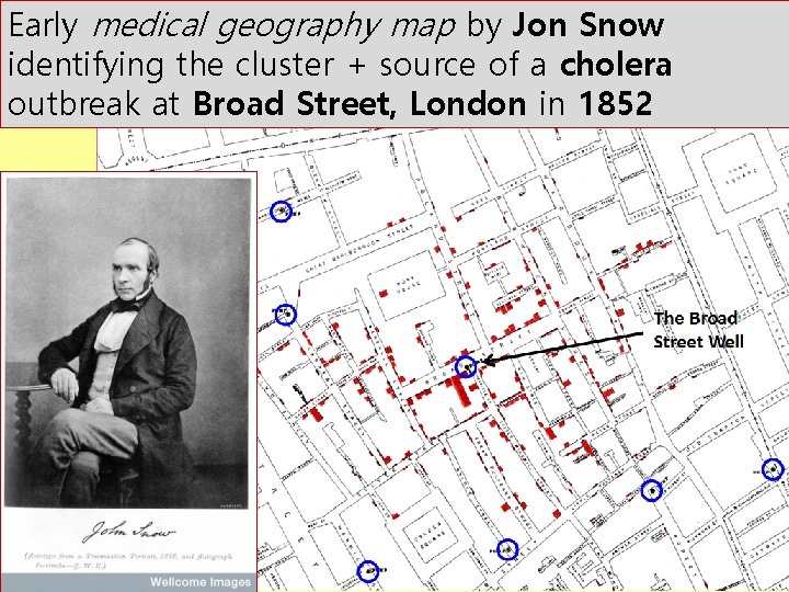 Early medical geography map by Jon Snow identifying the cluster + source of a