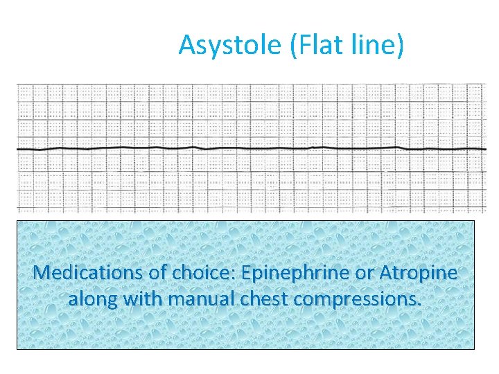 Asystole (Flat line) Medications of choice: Epinephrine or Atropine along with manual chest compressions.