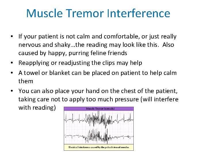 Muscle Tremor Interference • If your patient is not calm and comfortable, or just