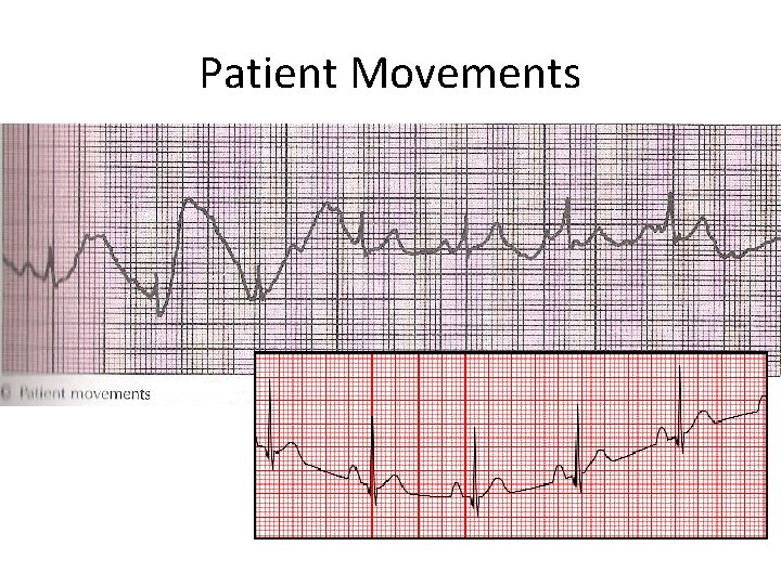 Patient Movements 