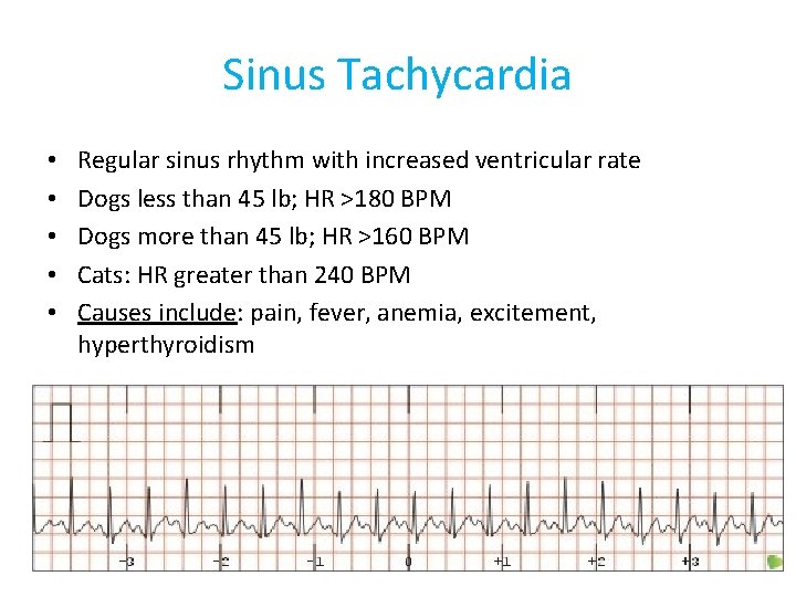 Sinus Tachycardia • • • Regular sinus rhythm with increased ventricular rate Dogs less