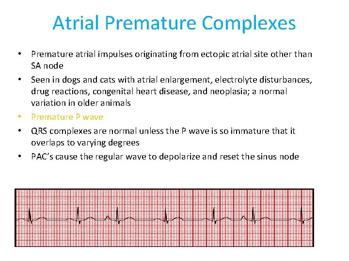 Atrial Premature Complexes • Premature atrial impulses originating from ectopic atrial site other than
