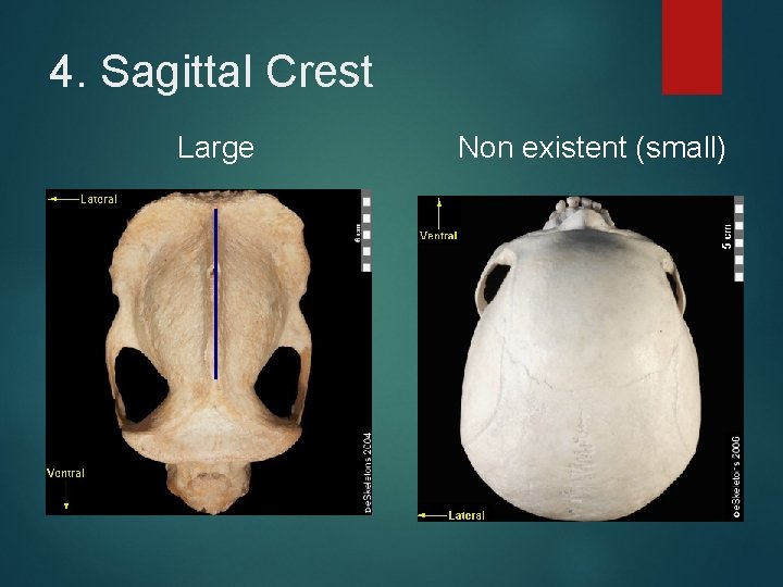 4. Sagittal Crest Large Non existent (small) 