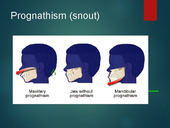 Prognathism (snout) 