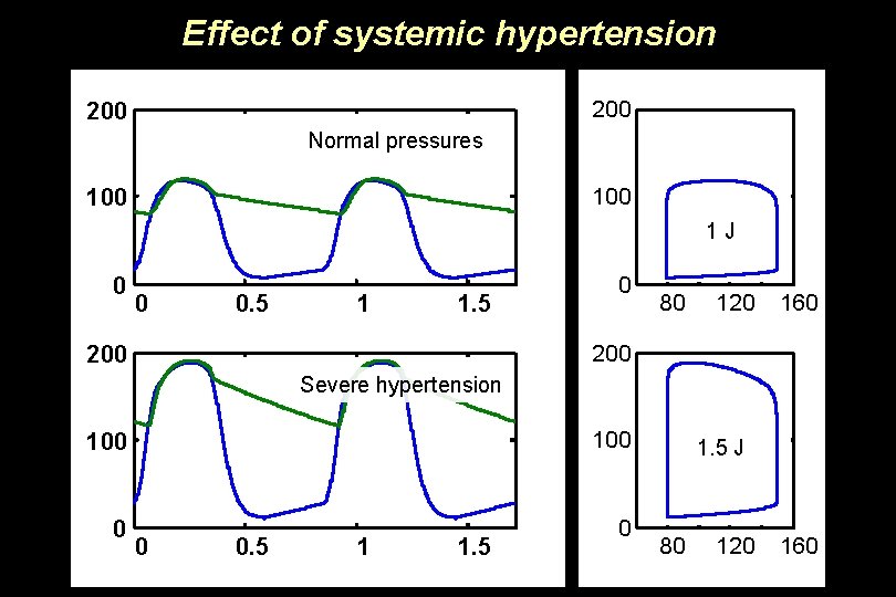 Effect of systemic hypertension 200 Normal pressures 100 1 J 0 0 0. 5