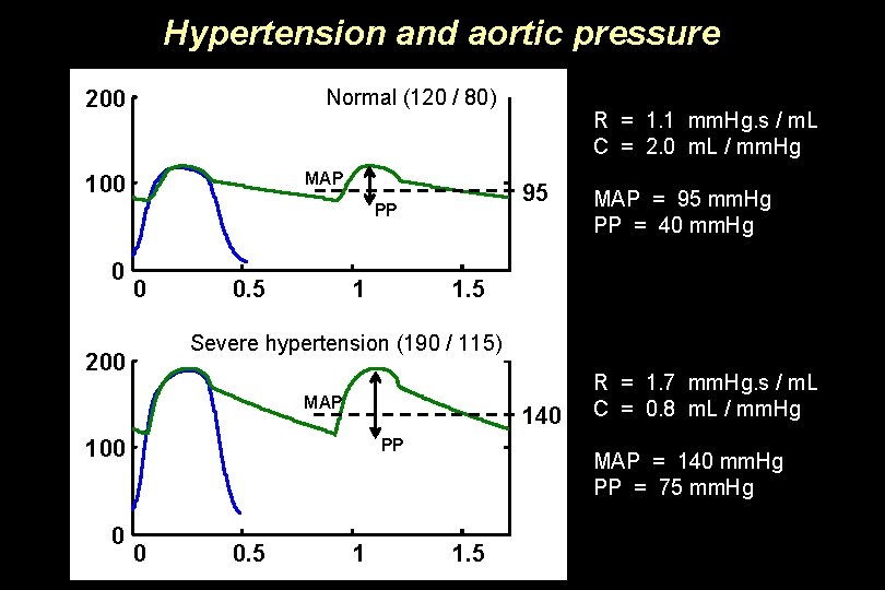 Hypertension and aortic pressure Normal (120 / 80) 200 MAP 100 95 PP 0