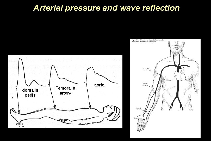 Arterial pressure and wave reflection dorsalis pedis Femoral a artery aorta 