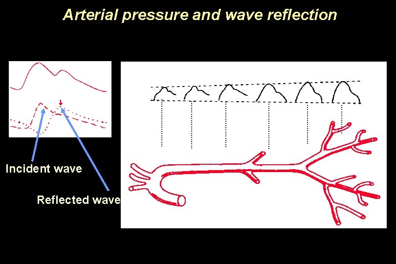 Arterial pressure and wave reflection . . . Incident wave Reflected wave . .