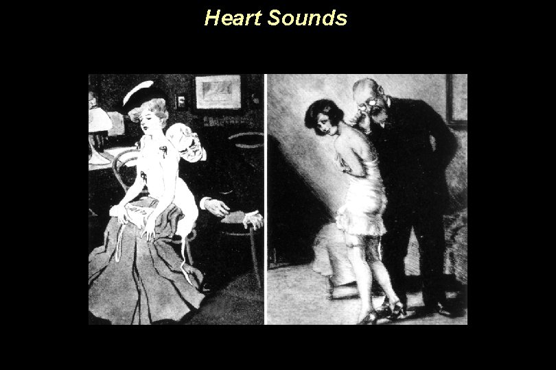 Heart Sounds 
