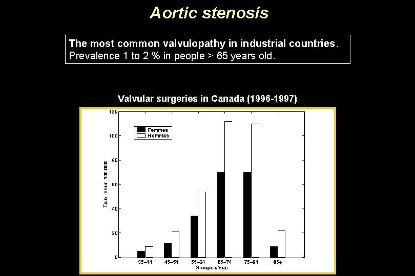 Aortic stenosis The most common valvulopathy in industrial countries. Prevalence 1 to 2 %