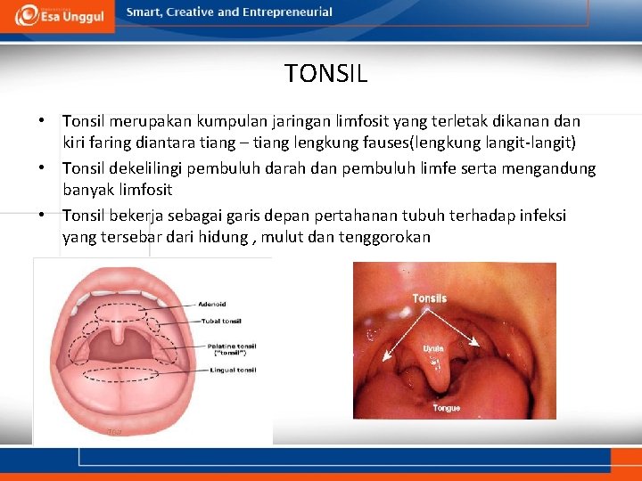 TONSIL • Tonsil merupakan kumpulan jaringan limfosit yang terletak dikanan dan kiri faring diantara