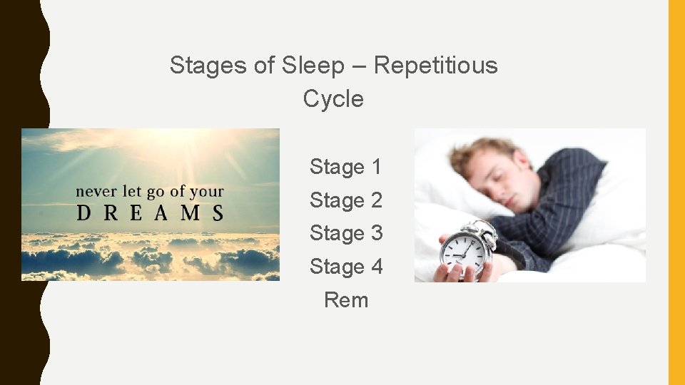 Stages of Sleep – Repetitious Cycle Stage 1 Stage 2 Stage 3 Stage 4