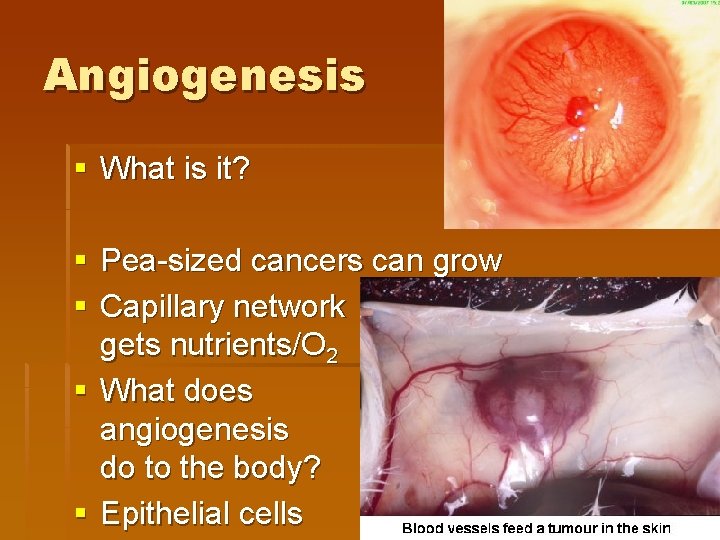 Angiogenesis § What is it? § Pea-sized cancers can grow § Capillary network gets