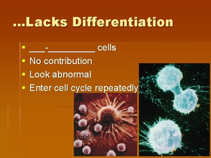 …Lacks Differentiation § § ___-_____ cells No contribution Look abnormal Enter cell cycle repeatedly