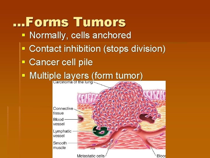 …Forms Tumors § § Normally, cells anchored Contact inhibition (stops division) Cancer cell pile