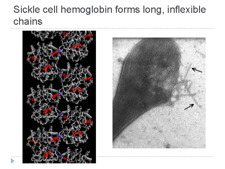 Sickle cell hemoglobin forms long, inflexible chains 