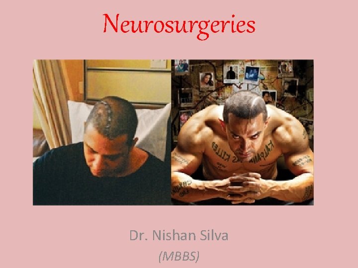 Neurosurgeries Dr. Nishan Silva (MBBS) 