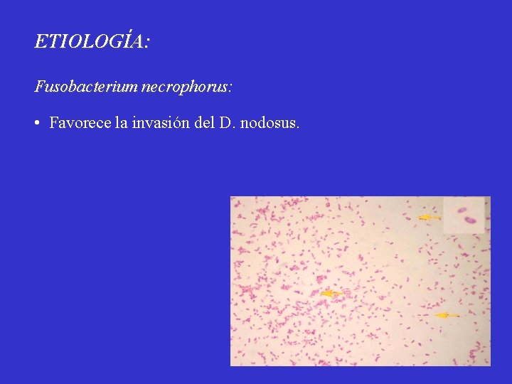 ETIOLOGÍA: Fusobacterium necrophorus: • Favorece la invasión del D. nodosus. 