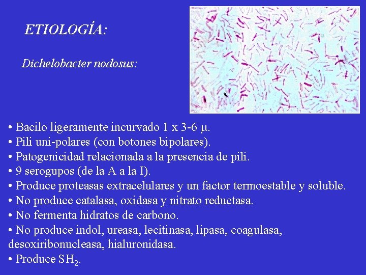 ETIOLOGÍA: Dichelobacter nodosus: • Bacilo ligeramente incurvado 1 x 3 -6 µ. • Pili