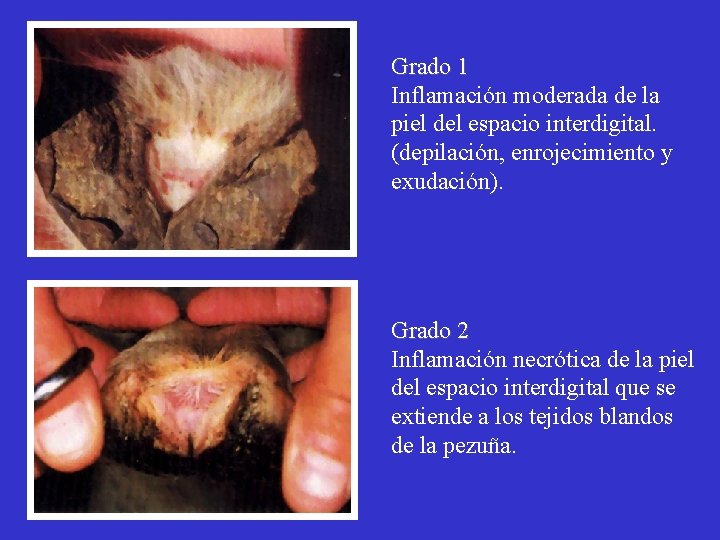 Grado 1 Inflamación moderada de la piel del espacio interdigital. (depilación, enrojecimiento y exudación).