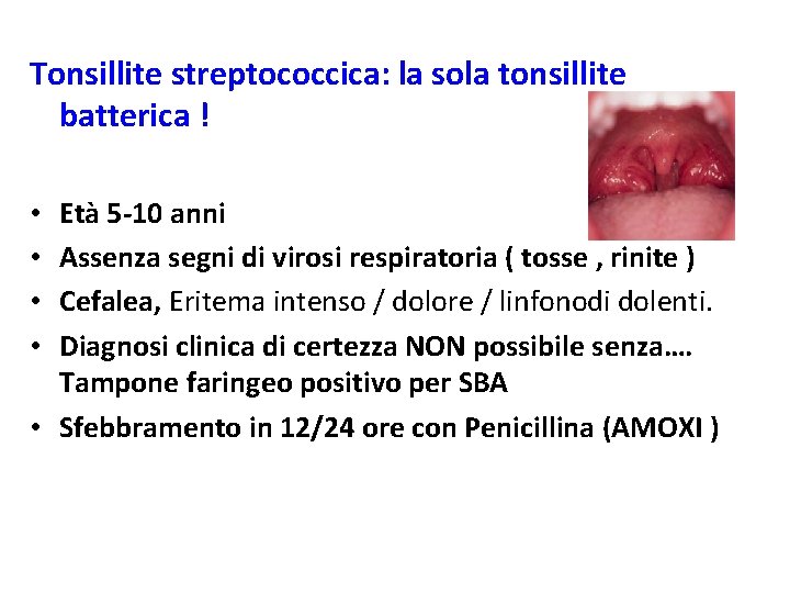 Tonsillite streptococcica: la sola tonsillite batterica ! Età 5 -10 anni Assenza segni di