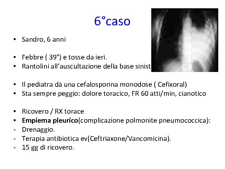 6°caso • Sandro, 6 anni • Febbre ( 39°) e tosse da ieri. •