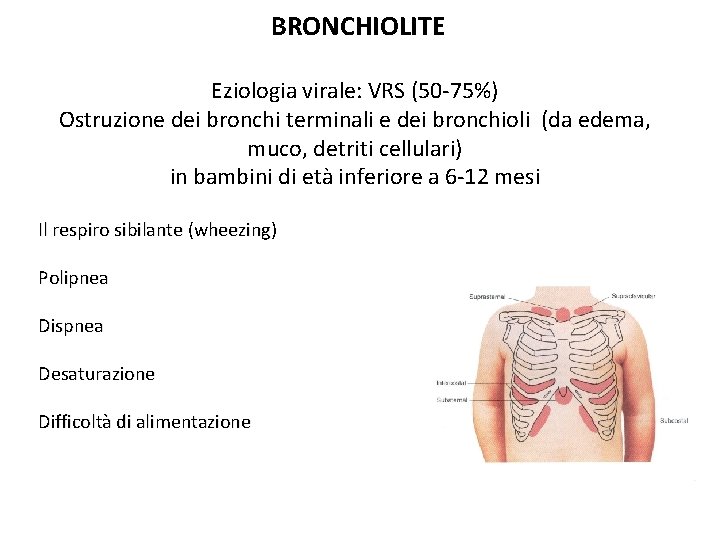 BRONCHIOLITE Eziologia virale: VRS (50 -75%) Ostruzione dei bronchi terminali e dei bronchioli (da