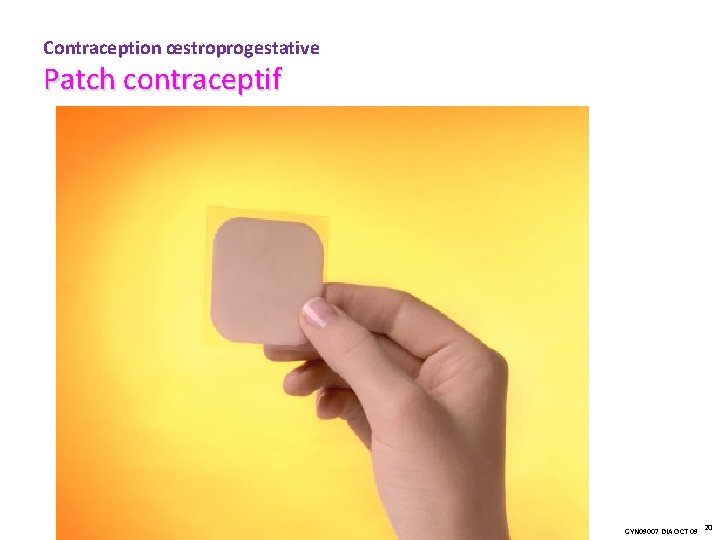Contraception œstroprogestative Patch contraceptif GYN 09007 DIA OCT 09 20 