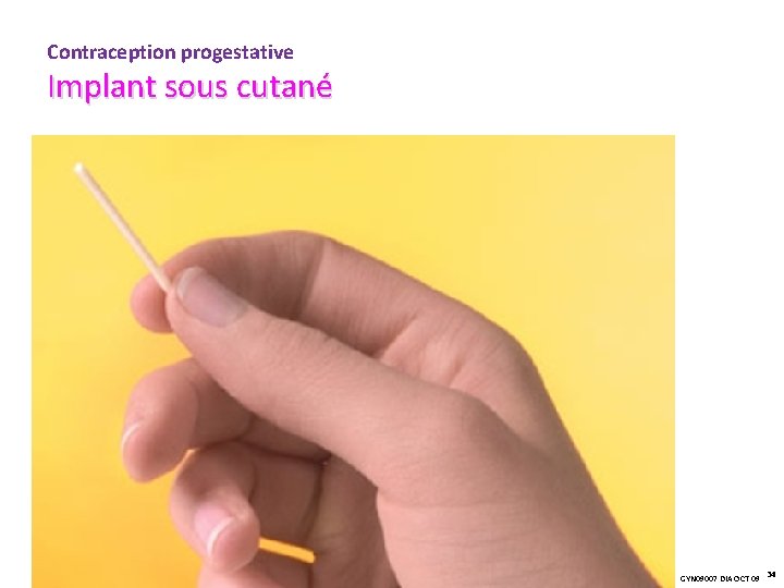 Contraception progestative Implant sous cutané GYN 09007 DIA OCT 09 34 