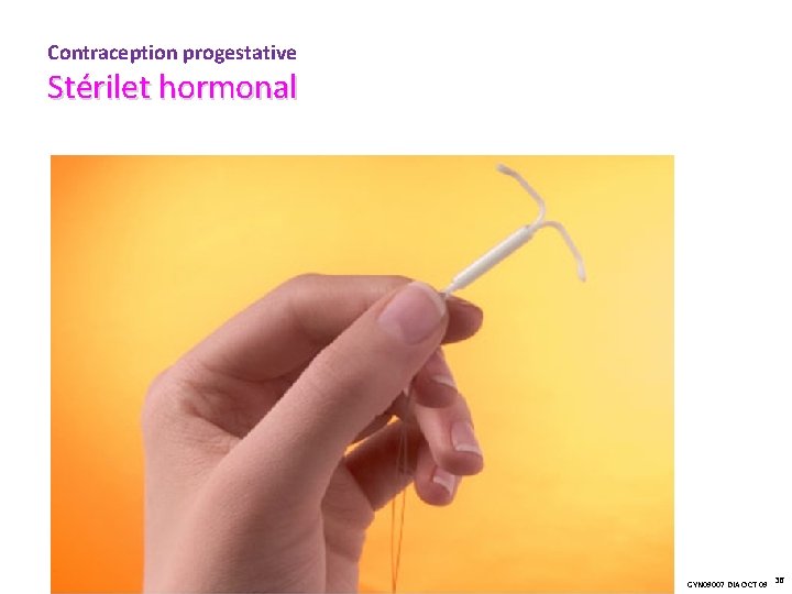 Contraception progestative Stérilet hormonal GYN 09007 DIA OCT 09 36 