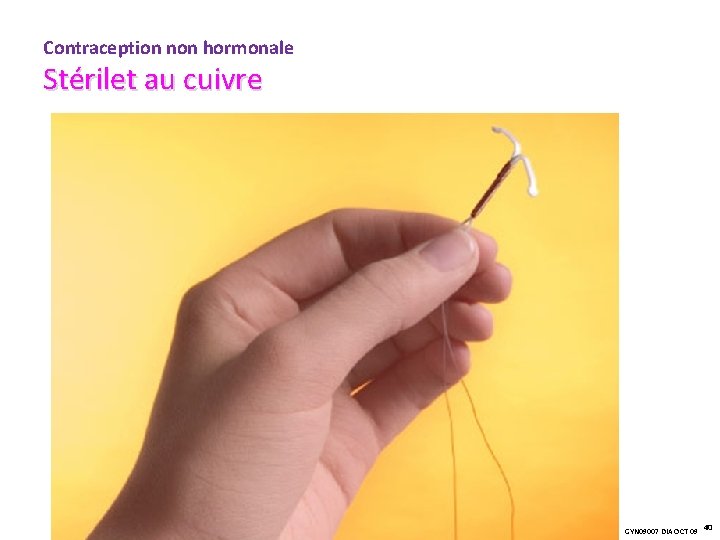 Contraception non hormonale Stérilet au cuivre GYN 09007 DIA OCT 09 40 