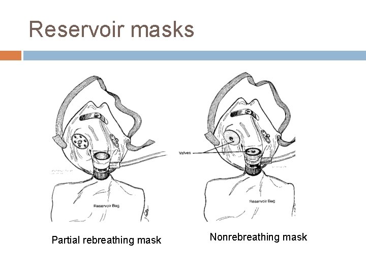 Reservoir masks Partial rebreathing mask Nonrebreathing mask 