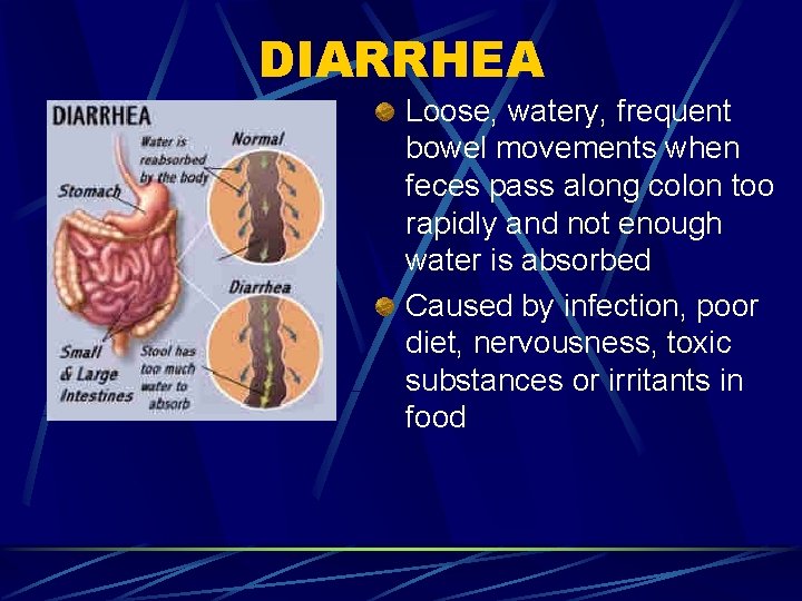 DIARRHEA Loose, watery, frequent bowel movements when feces pass along colon too rapidly and