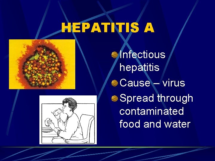 HEPATITIS A Infectious hepatitis Cause – virus Spread through contaminated food and water 