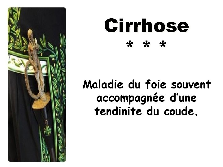 Cirrhose *** Maladie du foie souvent accompagnée d’une tendinite du coude. 