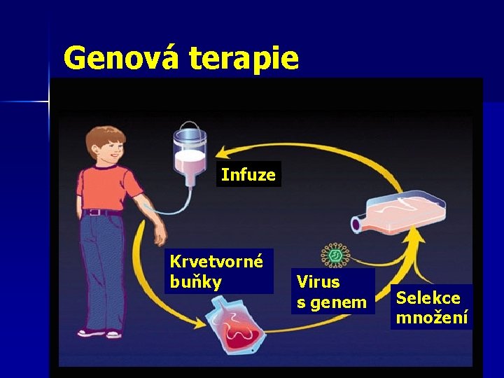 Genová terapie Infuze Krvetvorné buňky Virus s genem Selekce množení 