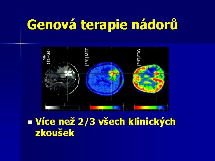 Genová terapie nádorů n Více než 2/3 všech klinických zkoušek 