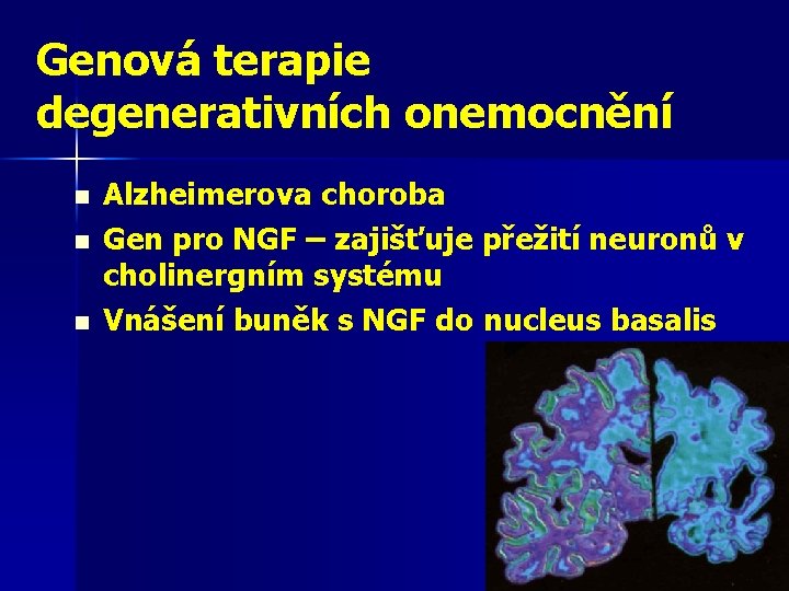 Genová terapie degenerativních onemocnění n n n Alzheimerova choroba Gen pro NGF – zajišťuje