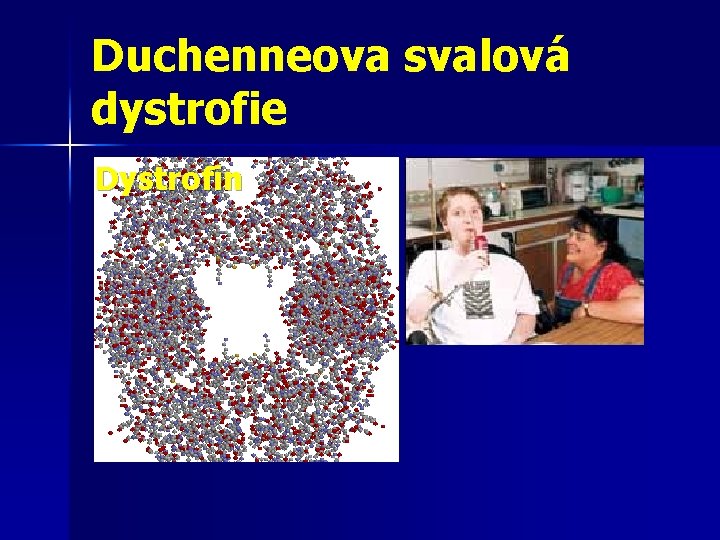 Duchenneova svalová dystrofie Dystrofin 