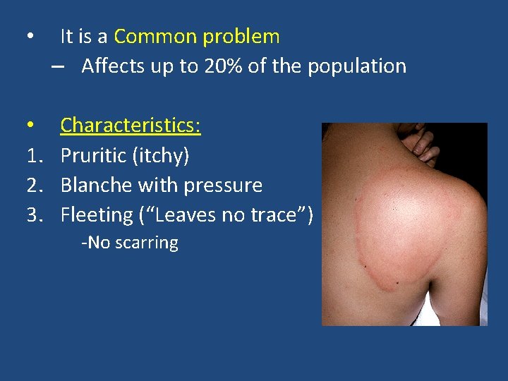 • • 1. 2. 3. It is a Common problem – Affects up • • 1. 2. 3. It is a Common problem – Affects up