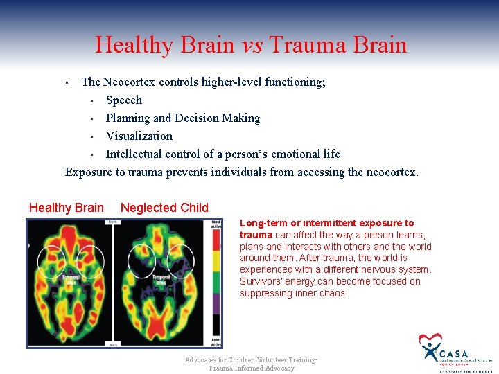Healthy Brain vs Trauma Brain The Neocortex controls higher-level functioning; • Speech • Planning Healthy Brain vs Trauma Brain The Neocortex controls higher-level functioning; • Speech • Planning