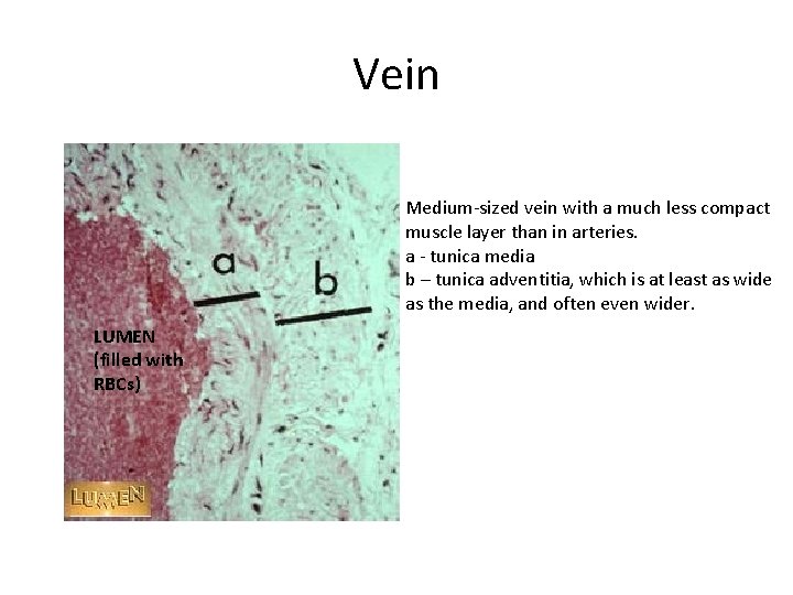 Vein Medium-sized vein with a much less compact muscle layer than in arteries. a