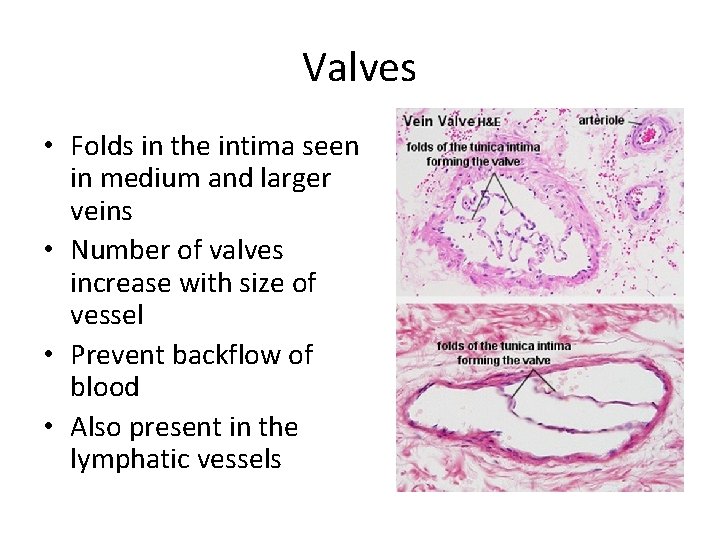 Valves • Folds in the intima seen in medium and larger veins • Number